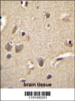 S100A1 Antibody
