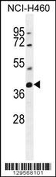 TECRL Antibody