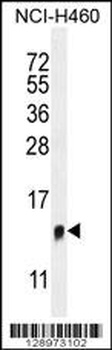 TMEM100 Antibody
