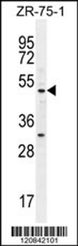 MEF2D Antibody