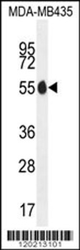 PAX1 Antibody