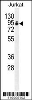 PAPOLA Antibody