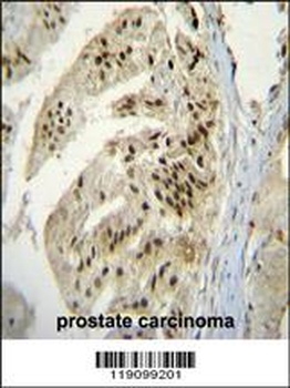 PAPOLA Antibody