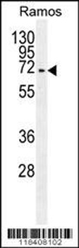 KNG1 Antibody