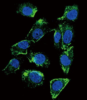 BTC Antibody