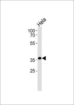 AKR1C3 Antibody