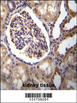 AKR1C3 Antibody