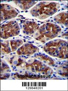 EPHX3 Antibody