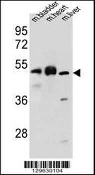 BTBD17 Antibody