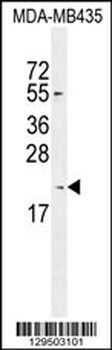 KLLN Antibody