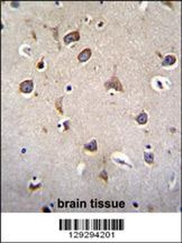 ZNF665 Antibody