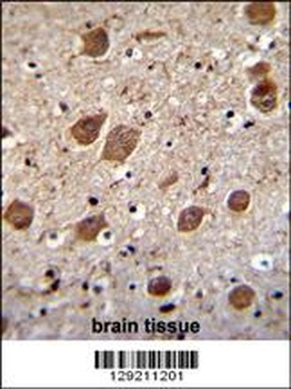 KCTD8 Antibody