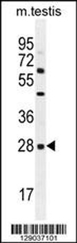 CLEC12B Antibody