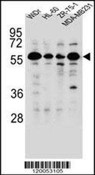 FOXC2 Antibody