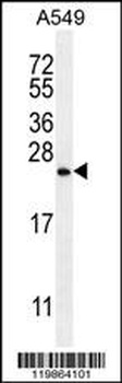 SNX24 Antibody