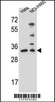 NTHL1 Antibody