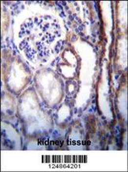 ATP6V1B1 Antibody