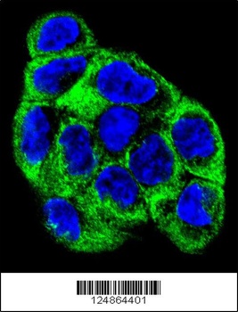 ATP6V1B1 Antibody