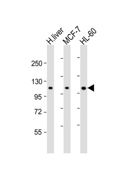 RSBN1 Antibody