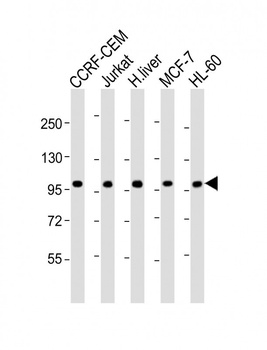 RSBN1 Antibody