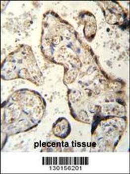 RSBN1 Antibody