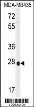 OR8B4 Antibody