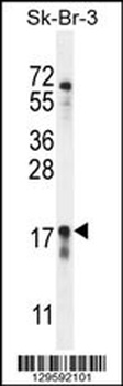 CA115 Antibody