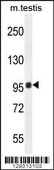 TMEM132E Antibody