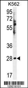 HSD11B1L Antibody