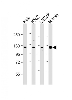 KDM4C Antibody