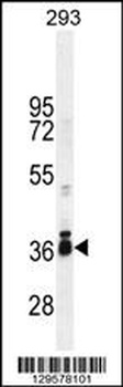 STRA8 Antibody