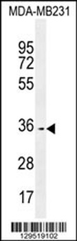OR10Z1 Antibody