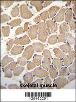 GAS2L2 Antibody