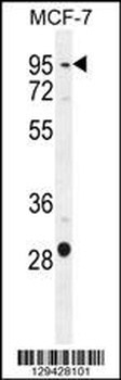 PTCHD3 Antibody