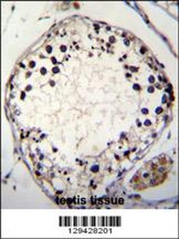 PTCHD3 Antibody
