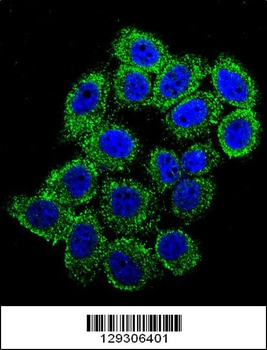 EDN1 Antibody