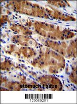 CCDC84 Antibody