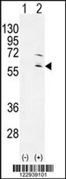 RPS6KL1 Antibody