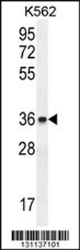 ETV2 Antibody