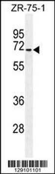 HAUS3 Antibody