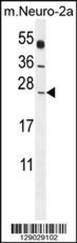 POLR2J Antibody