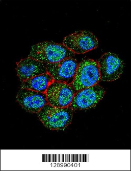 TSPYL6 Antibody