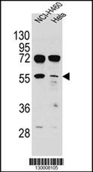 TSPYL6 Antibody