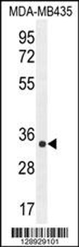 ALKBH6 Antibody