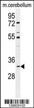 ALKBH6 Antibody