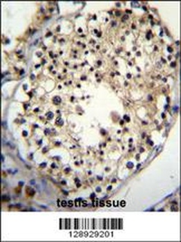 ALKBH6 Antibody