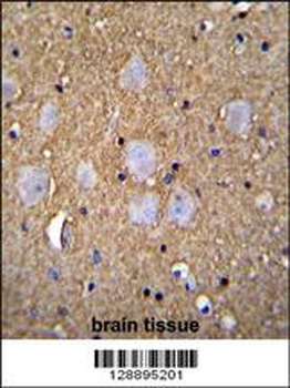 CAMSAP1 Antibody