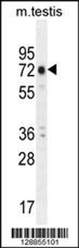 ANKRD5 Antibody