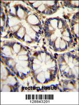 TNFRSF1A Antibody