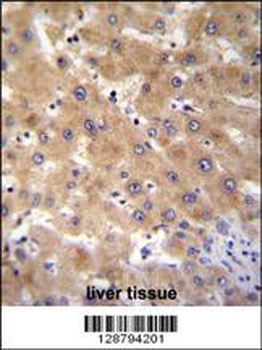 GAGE12B Antibody